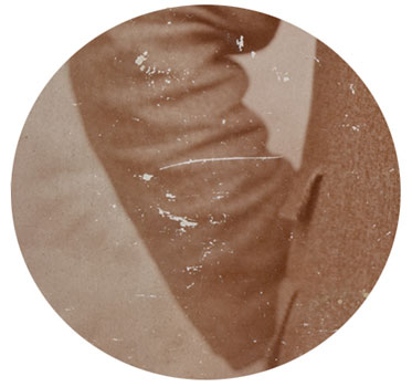 Abrasion